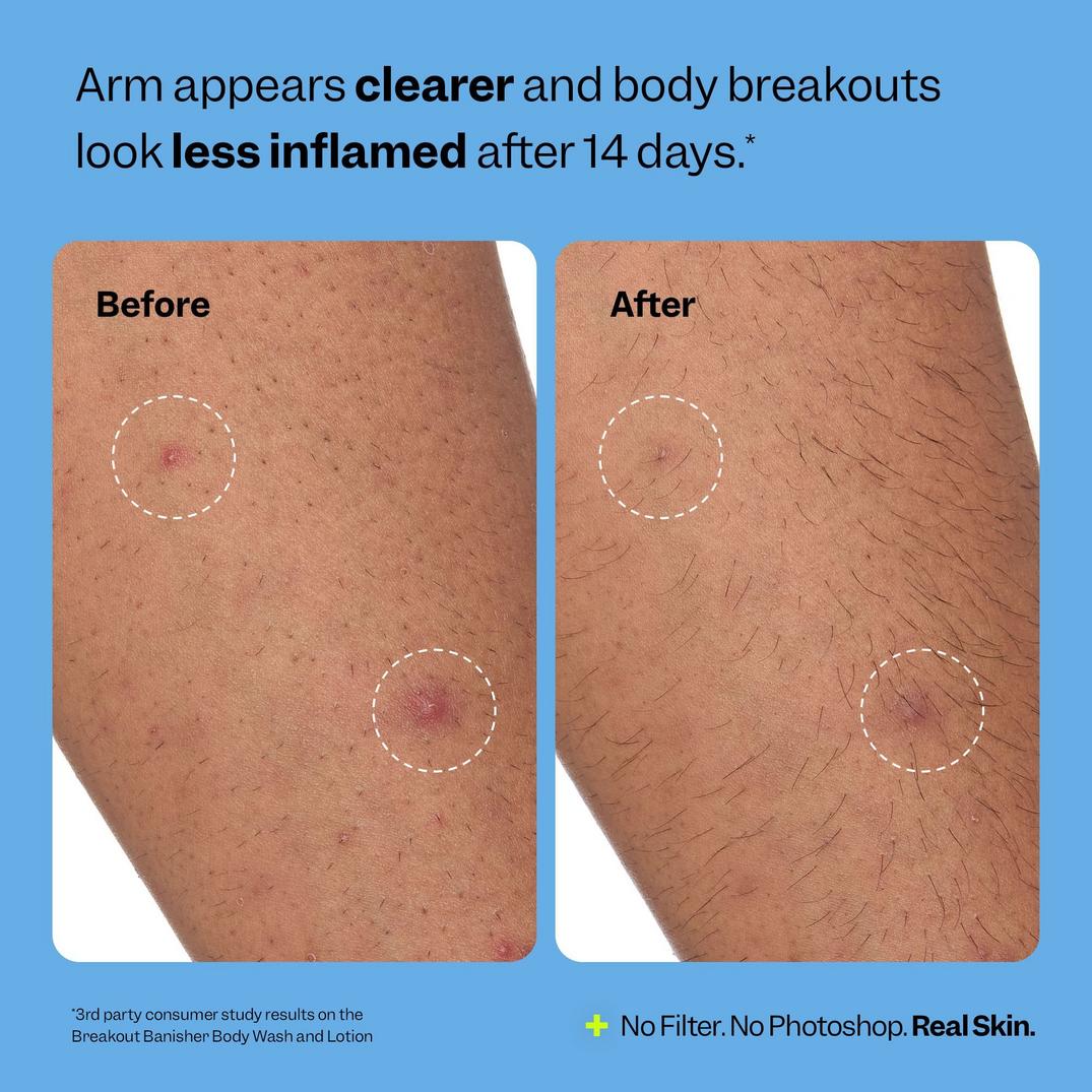 Peach Slices Breakout Banisher Body Lotion