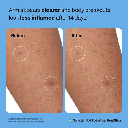 Peach Slices Breakout Banisher Body Lotion