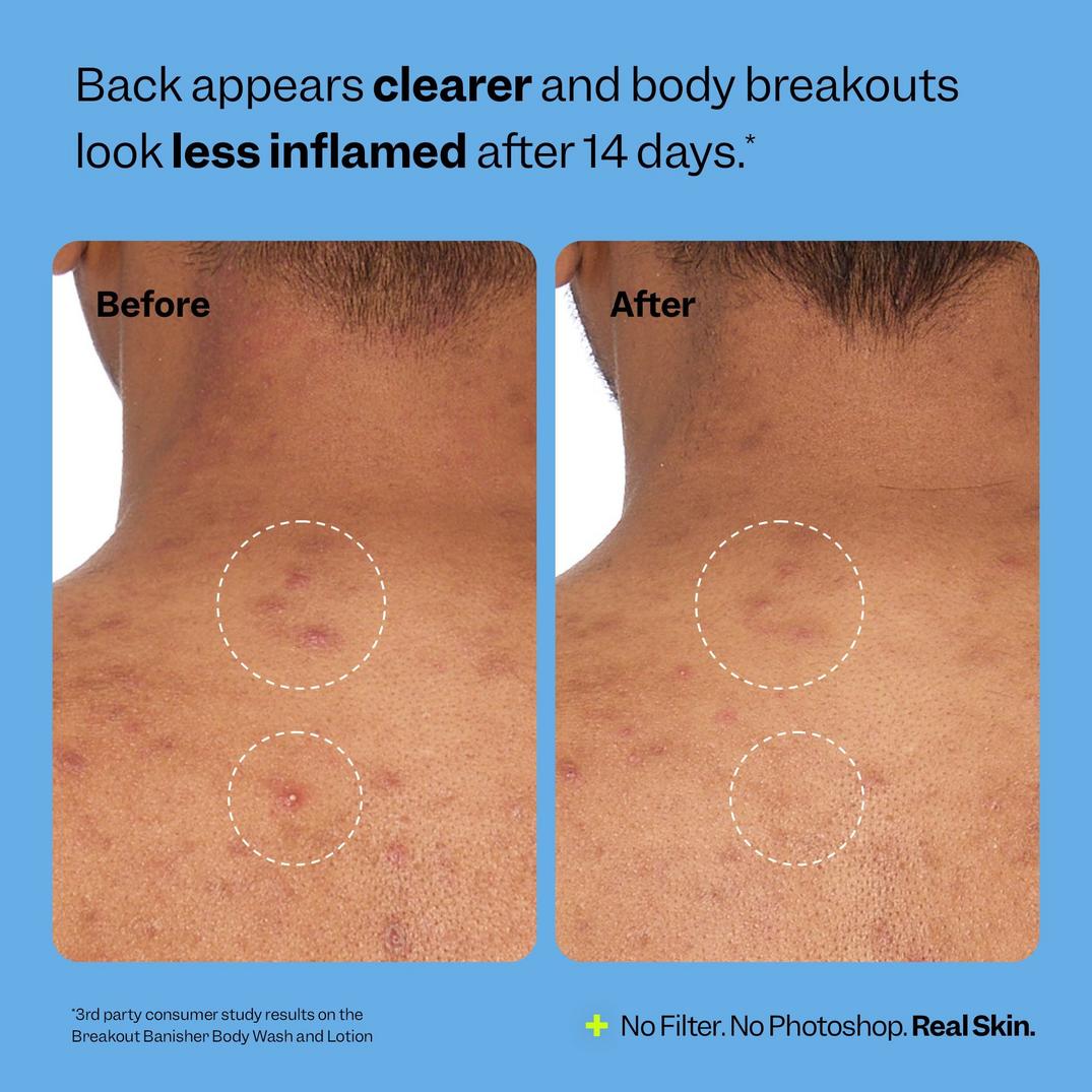 Peach Slices Breakout Banisher Body Wash