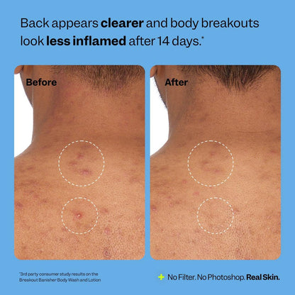 Peach Slices Breakout Banisher Body Wash