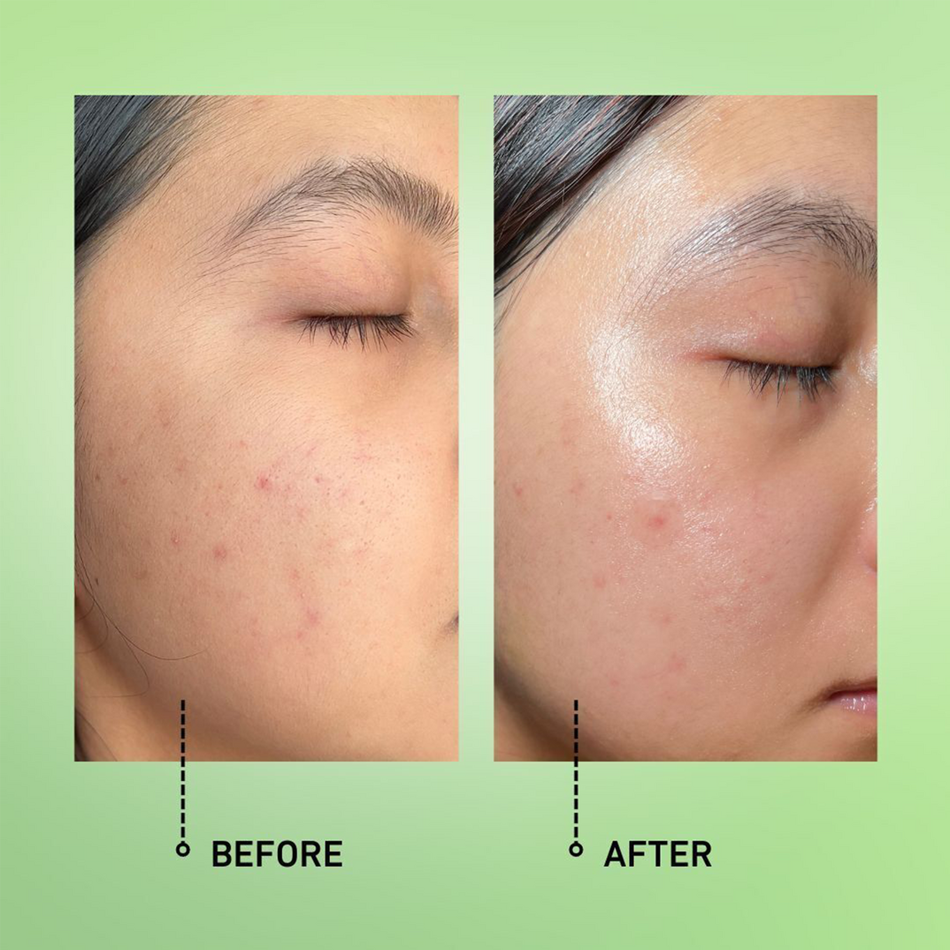 good light Alphabet Oil