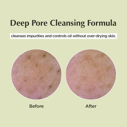 ma:nyo Deep Pore Cleansing Soda Foam