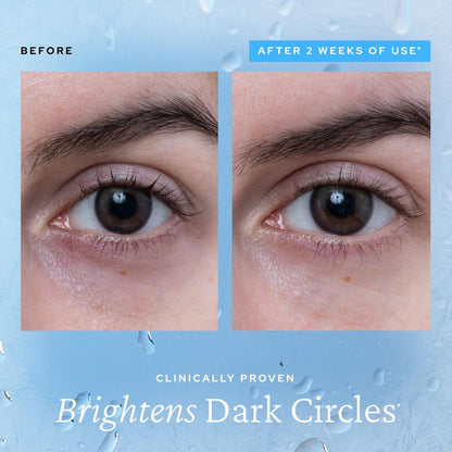 belif Aqua Bomb Depuffing Eye Gel with Caffeine + Hyaluronic Acid