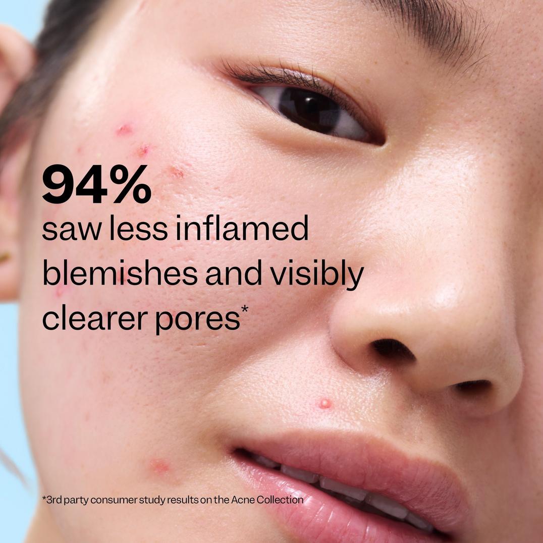 Peach Slices 3-Step Acne Starter Kit