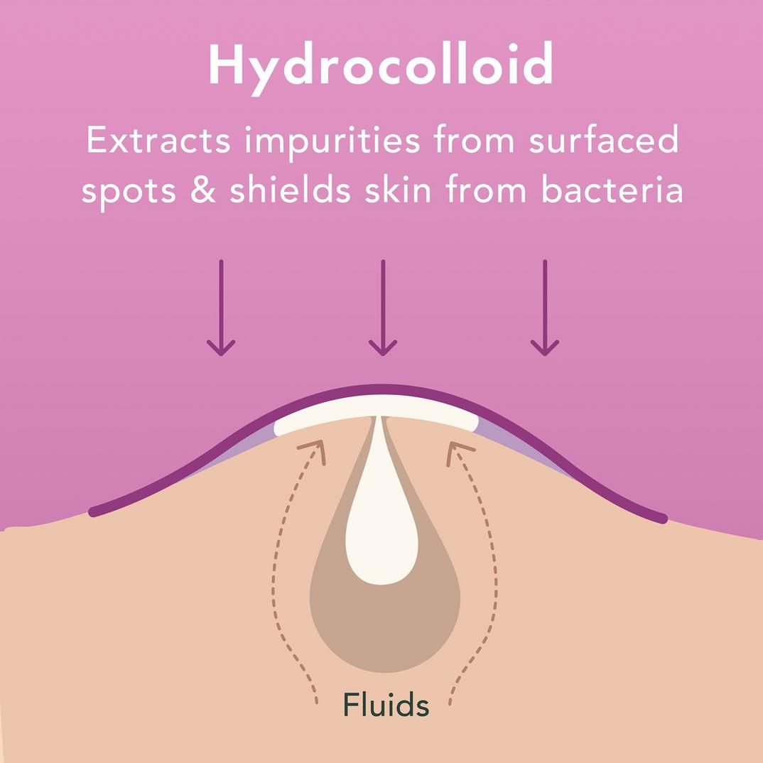 Rael Miracle Patch Overnight Spot Cover