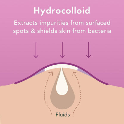 Rael Miracle Patch Overnight Spot Cover