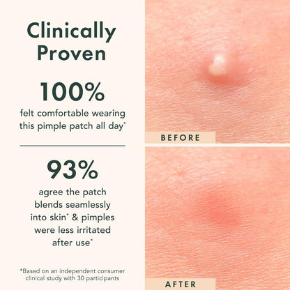 Rael Miracle Patch Invisible Spot Cover