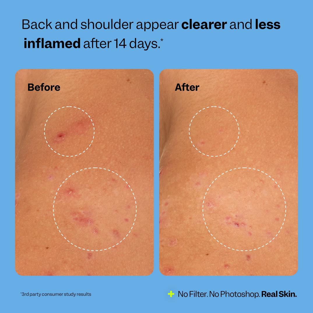 Peach Slices Breakout Banisher Body Spray