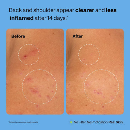 Peach Slices Breakout Banisher Body Spray