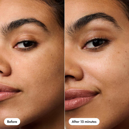 Hero Cosmetics Rescue Patch Replenishing Cream Patches