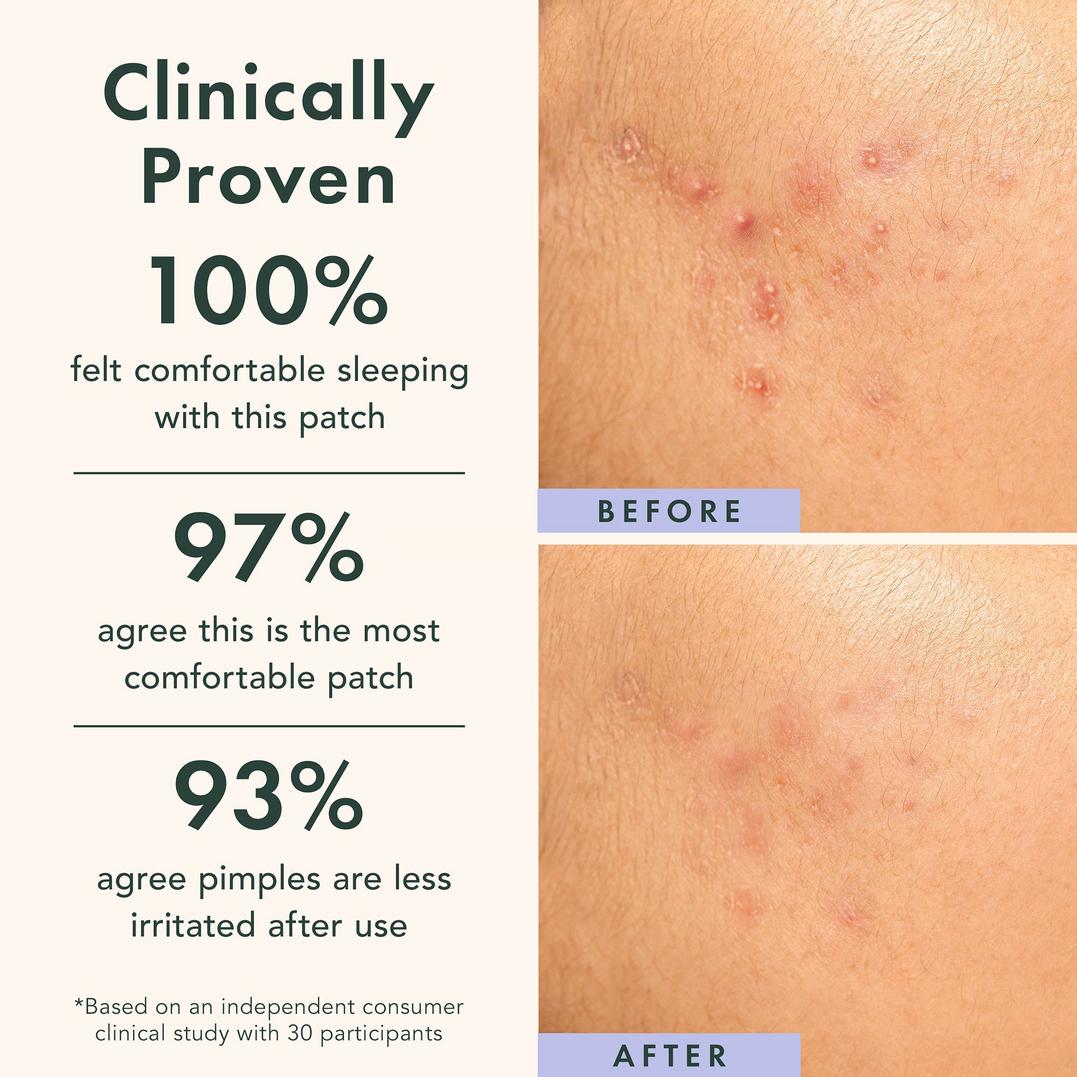 Rael Miracle Patch Spot Control Cover