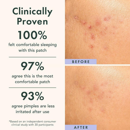 Rael Miracle Patch Spot Control Cover