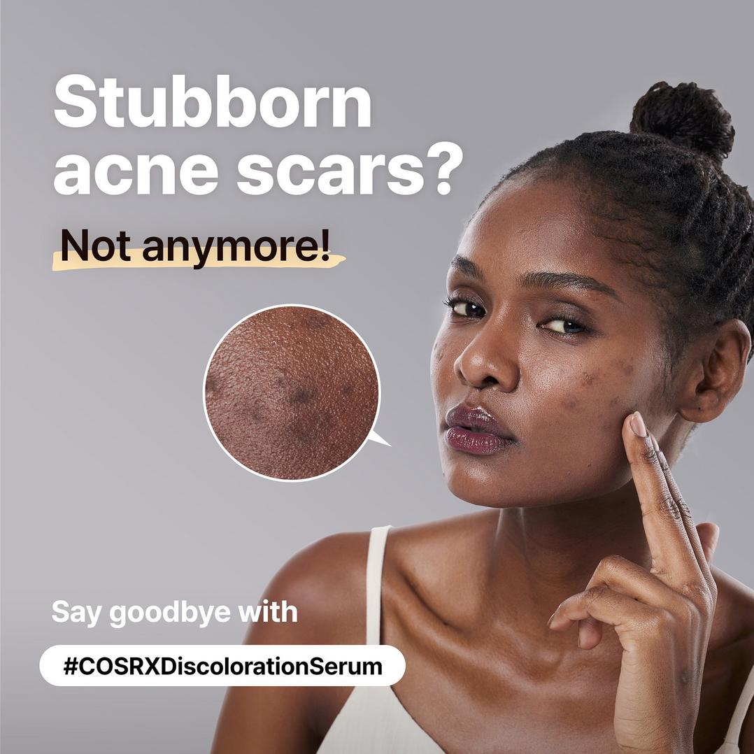 COSRX The Alpha-Arbutin 2 Discoloration Care Serum