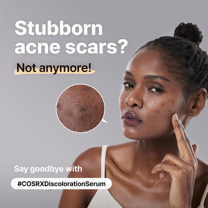 COSRX The Alpha-Arbutin 2 Discoloration Care Serum