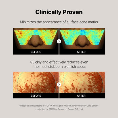 COSRX The Alpha-Arbutin 2 Discoloration Care Serum