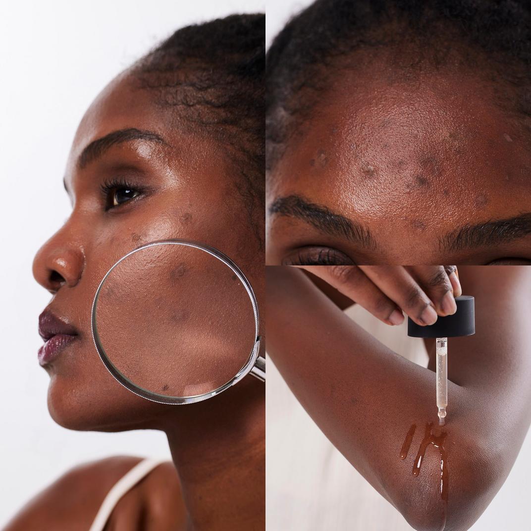 COSRX The Alpha-Arbutin 2 Discoloration Care Serum