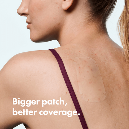 Hero Cosmetics Mighty Patch Body Acne Pimple Patches