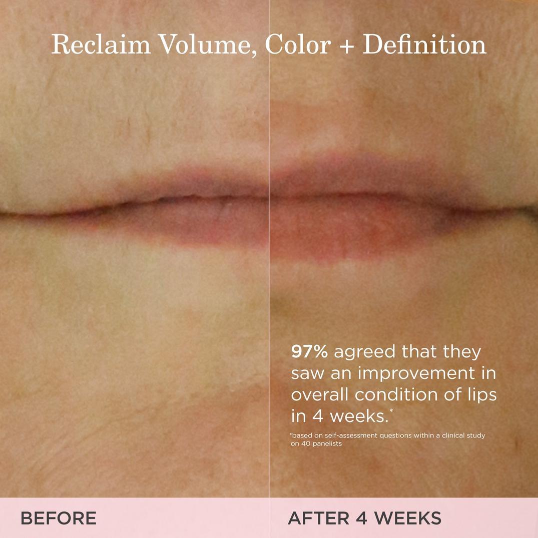 TATCHA The Kissu Lip Treatment Volume-Restoring Lip Serum