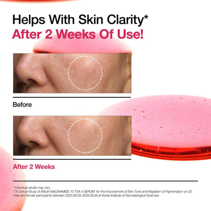 ANUA Niacinamide 10 TXA 4 Serum for Brightening and Dark Spots