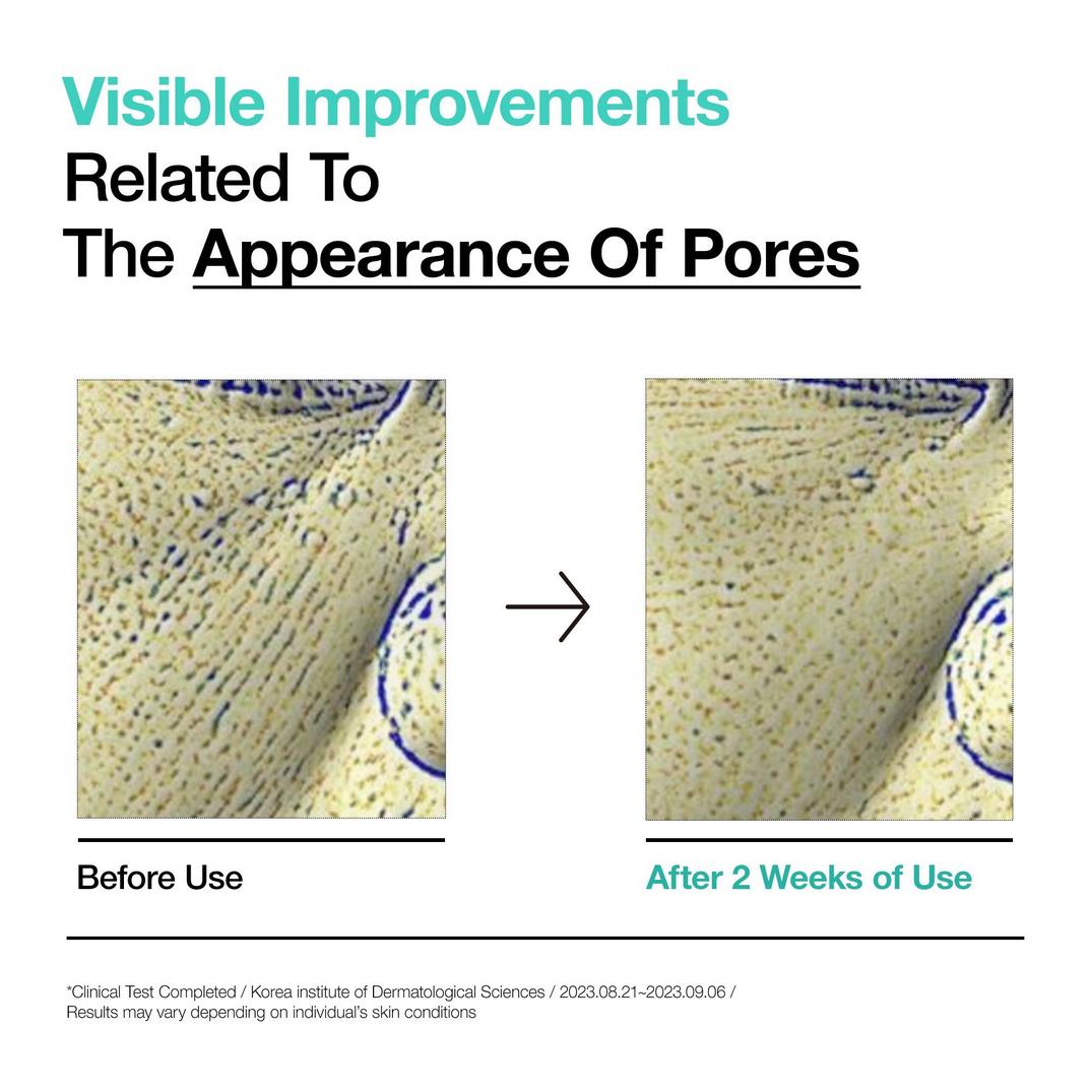 ANUA BHA 2% Gentle Exfoliating Toner