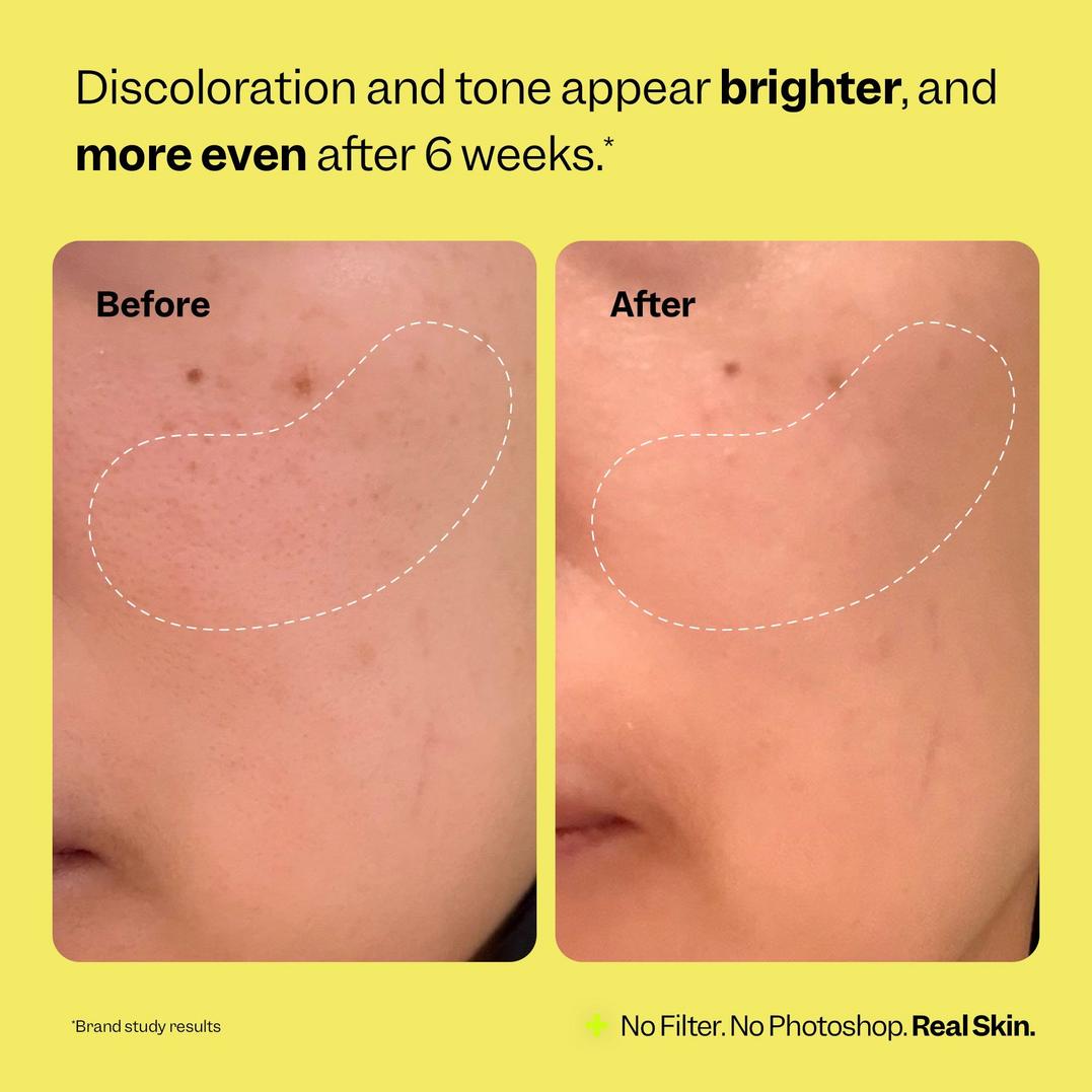 Peach Slices Super Fade Discoloration Serum