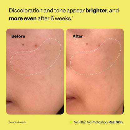 Peach Slices Super Fade Discoloration Serum