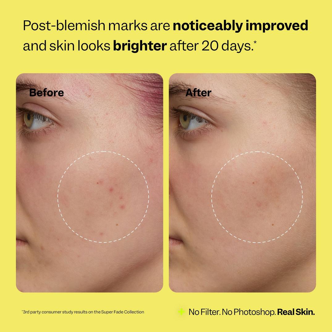 Peach Slices Super Fade Discoloration Moisturizer