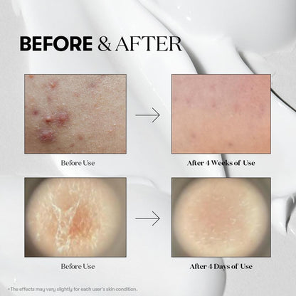 VT Cosmetics Reedle Shot 50