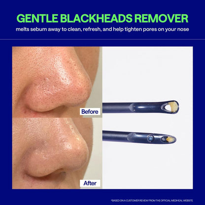 MEDIHEAL Blackhead Melting Clear Nose Patch