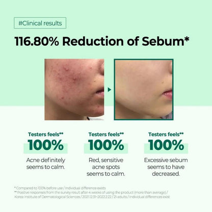 SOME BY MI AHA BHA PHA 30 Days Miracle Toner