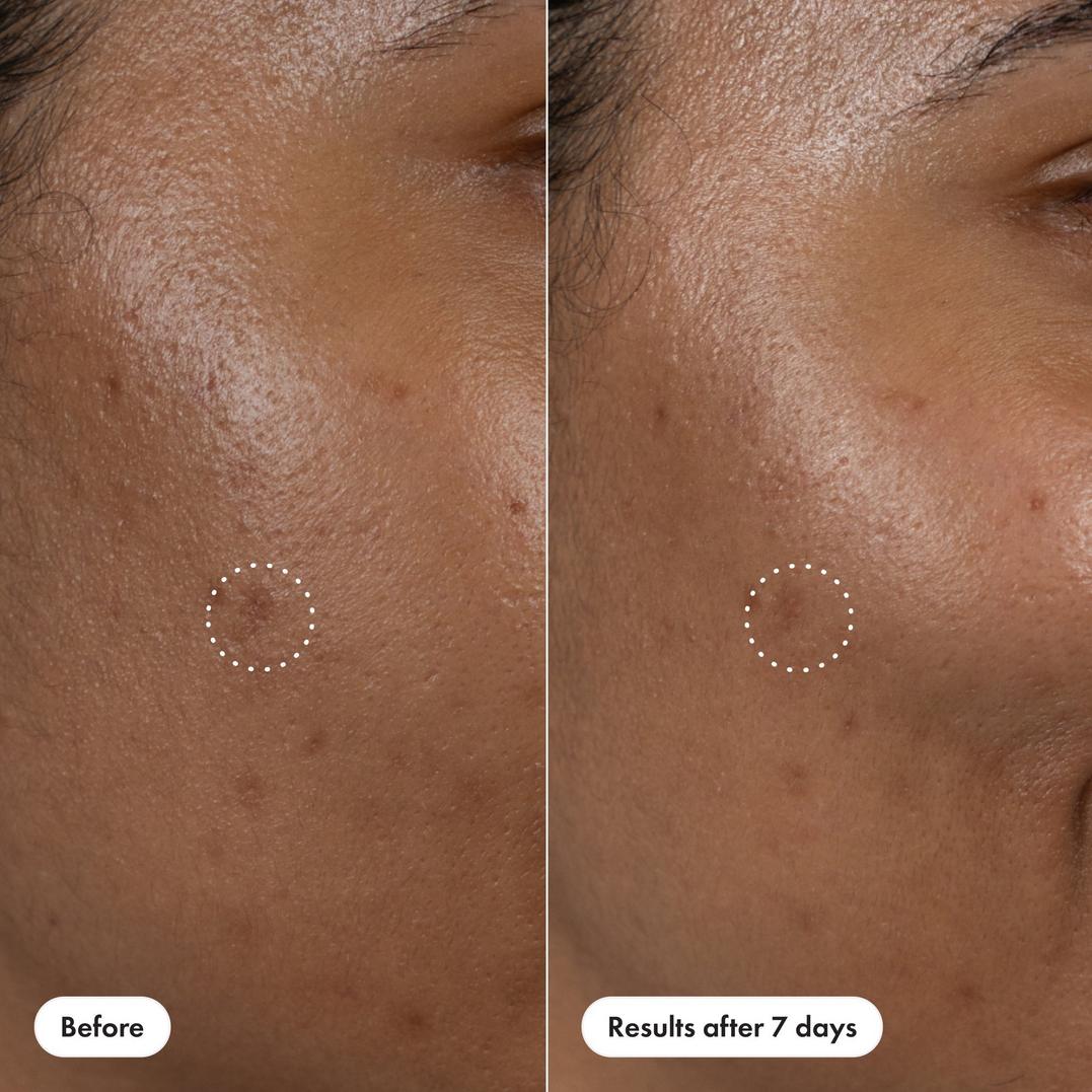 Hero Cosmetics Dark Spot Corrector