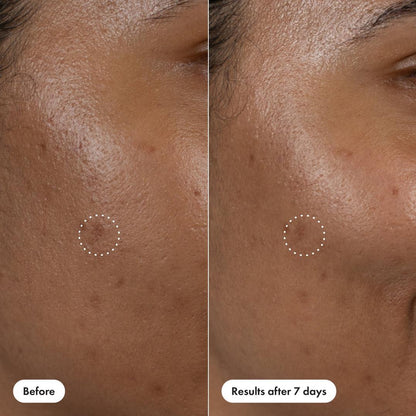 Hero Cosmetics Dark Spot Corrector