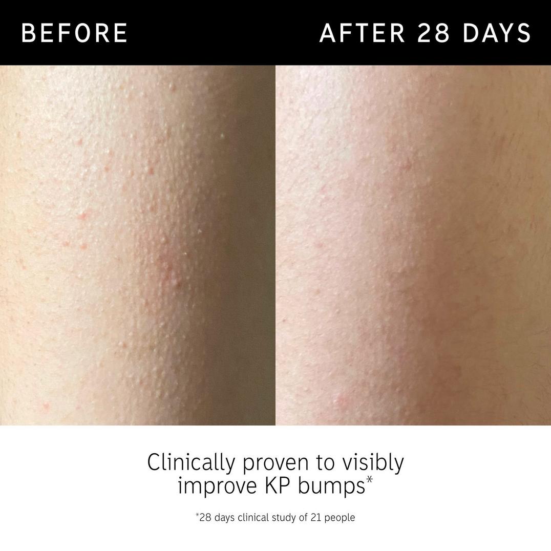 The INKEY List Glycolic Acid Exfoliating Body Stick