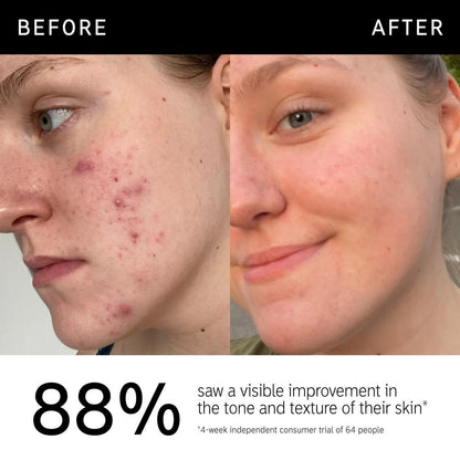 The INKEY List 15% Vitamin C & EGF Brightening Serum