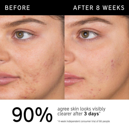 The INKEY List Salicylic Acid Acne + Blackhead Cleanser