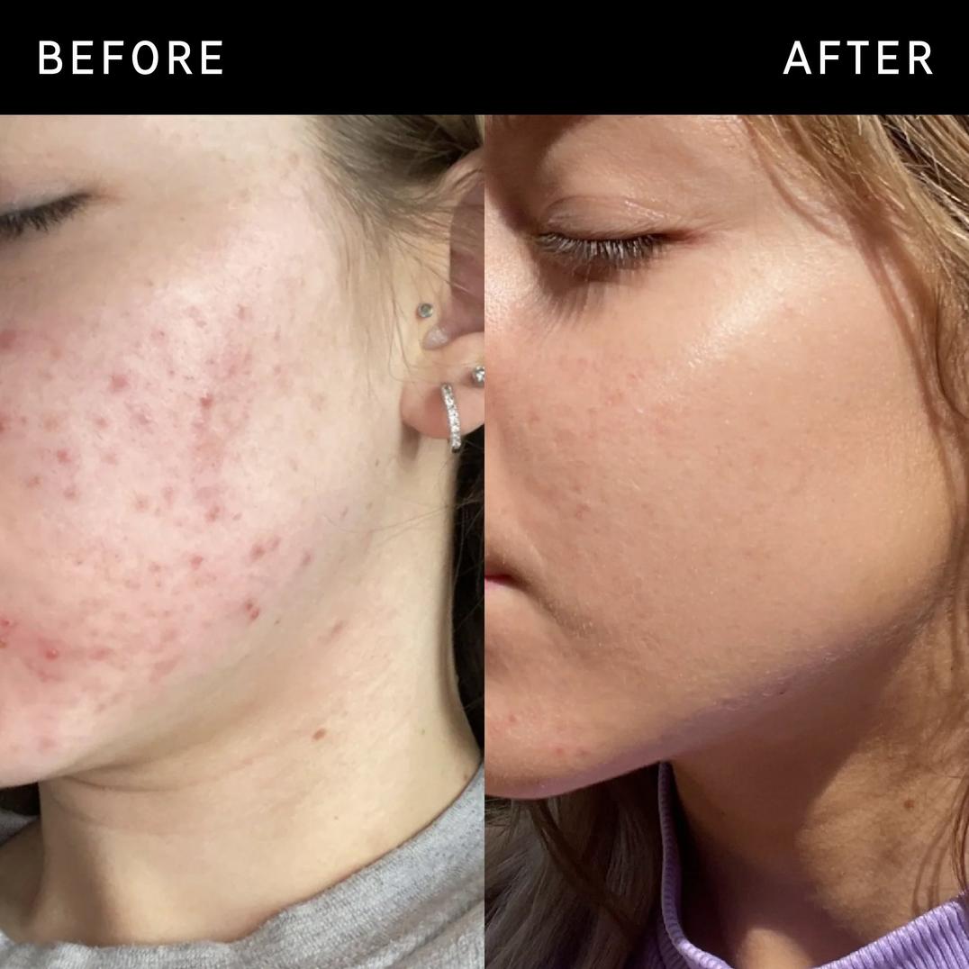 INKEY Niacinamide Oil Control Serum