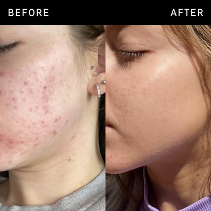 INKEY Niacinamide Oil Control Serum