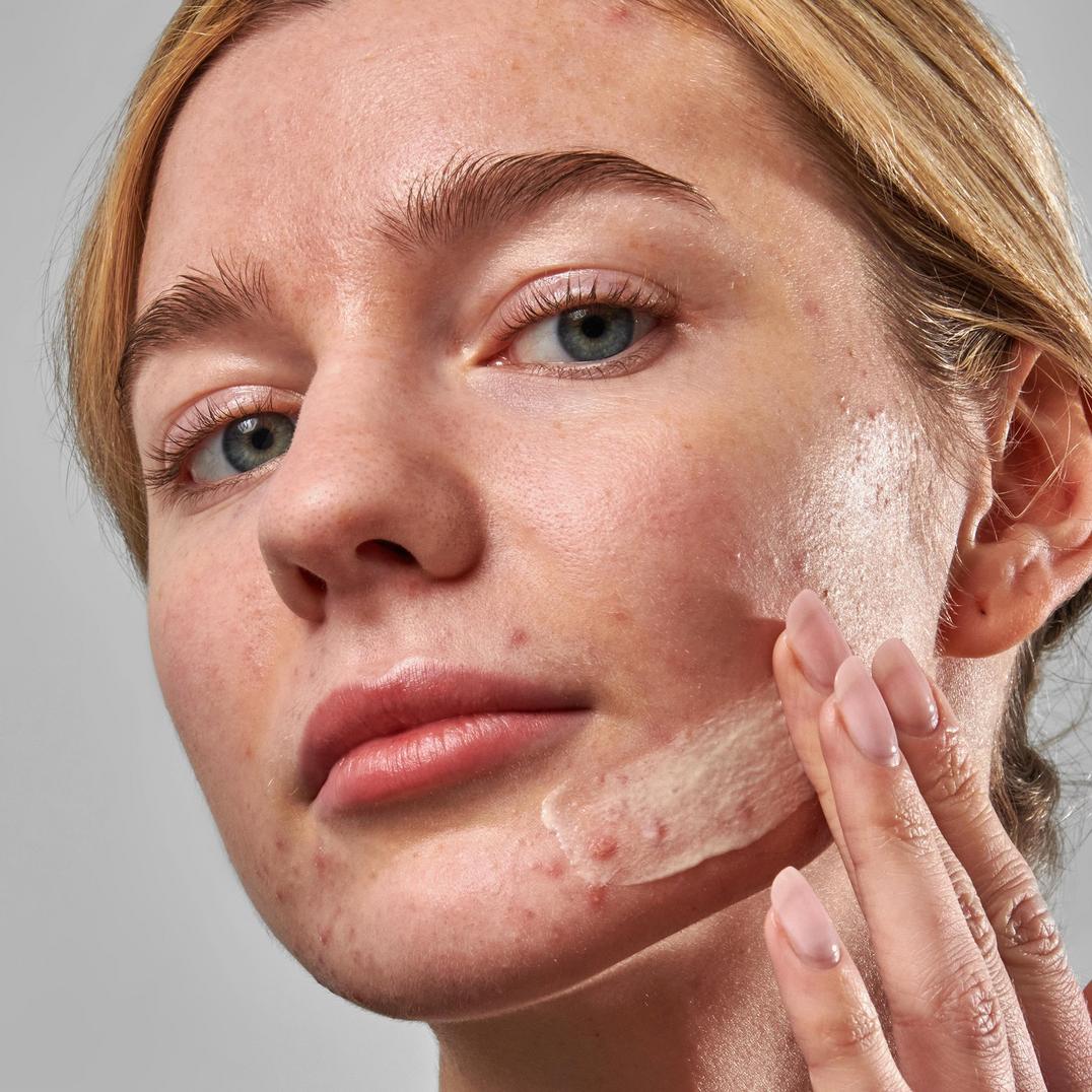 The INKEY List SuperSolutions Blemish Clearing Moisturizer 2% Novoretin