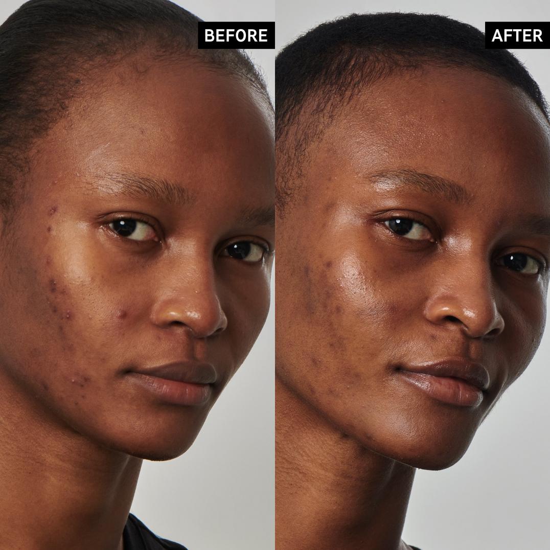 INKEY SuperSolutions 20% Niacinamide Serum