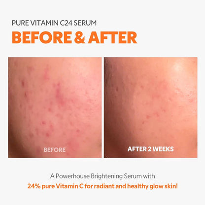 TIRTIR Pure Vitamin C24 Serum