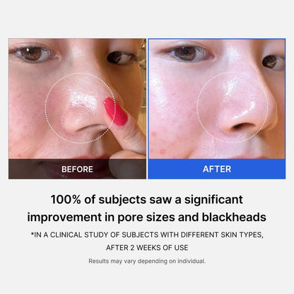 medicube Zero Pore Pad