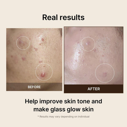 medicube Deep Vita C Pad