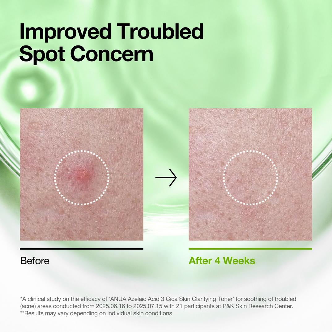 ANUA Azelaic Acid 3 Cica Skin Clarifying Toner