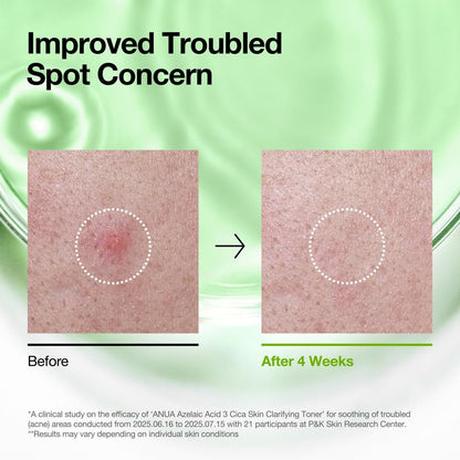 ANUA Azelaic Acid 3 Cica Skin Clarifying Toner