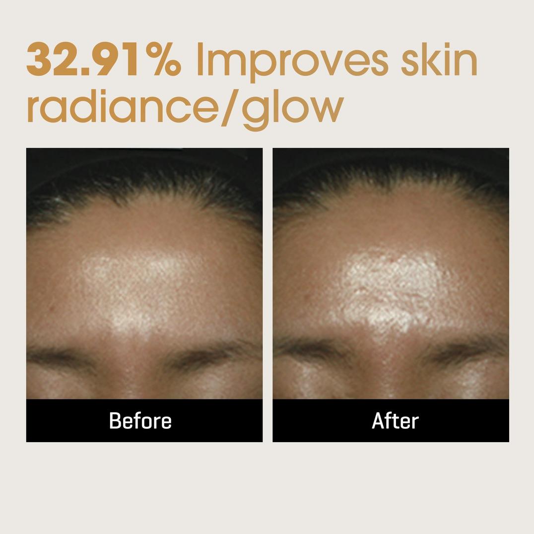 SOME BY MI Galactomyces Pure Vitamin C Glow Serum