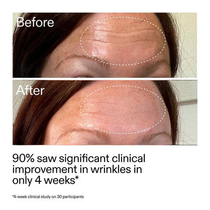 The INKEY List Starter Retinol Serum for Fine lines + Wrinkles