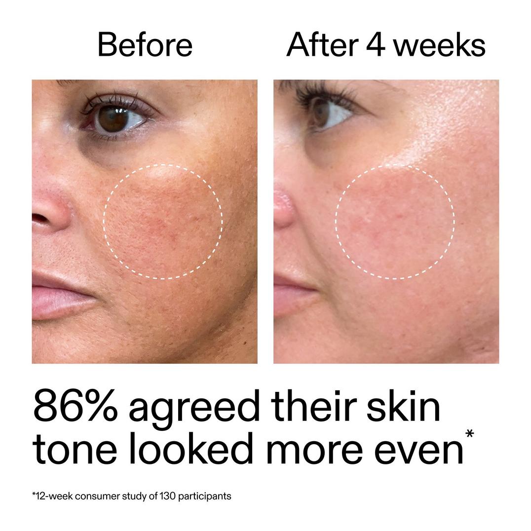 The INKEY List Starter Retinol Serum for Fine lines + Wrinkles