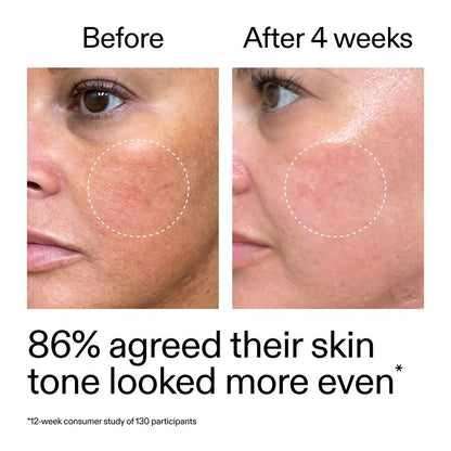 The INKEY List Starter Retinol Serum for Fine lines + Wrinkles