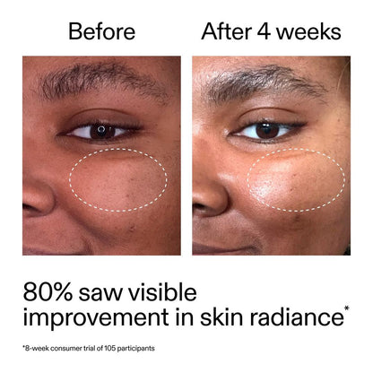 The INKEY List Advanced Retinal Serum for Fine lines + Wrinkles