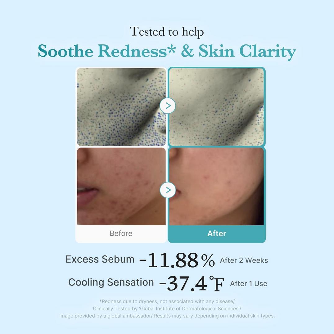 medicube Azelaic Acid Niacinamide Clarifying Toner